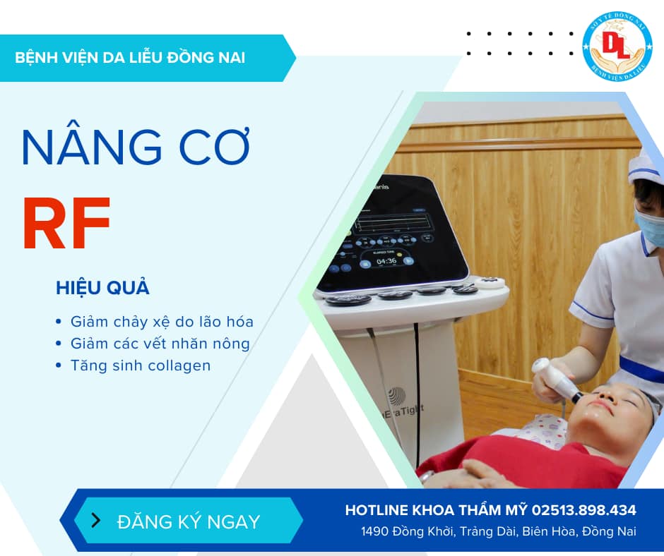 Nâng cơ mặt bằng máy RF