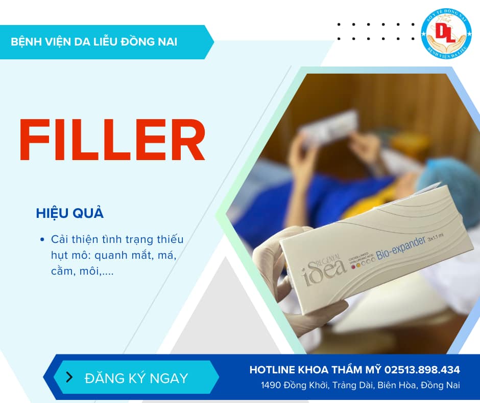 Tiem filler